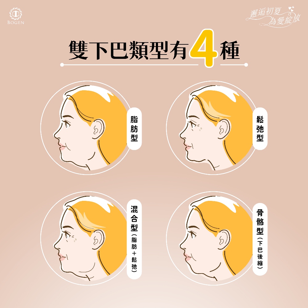 雙下巴類型,雙下巴,博恩妍